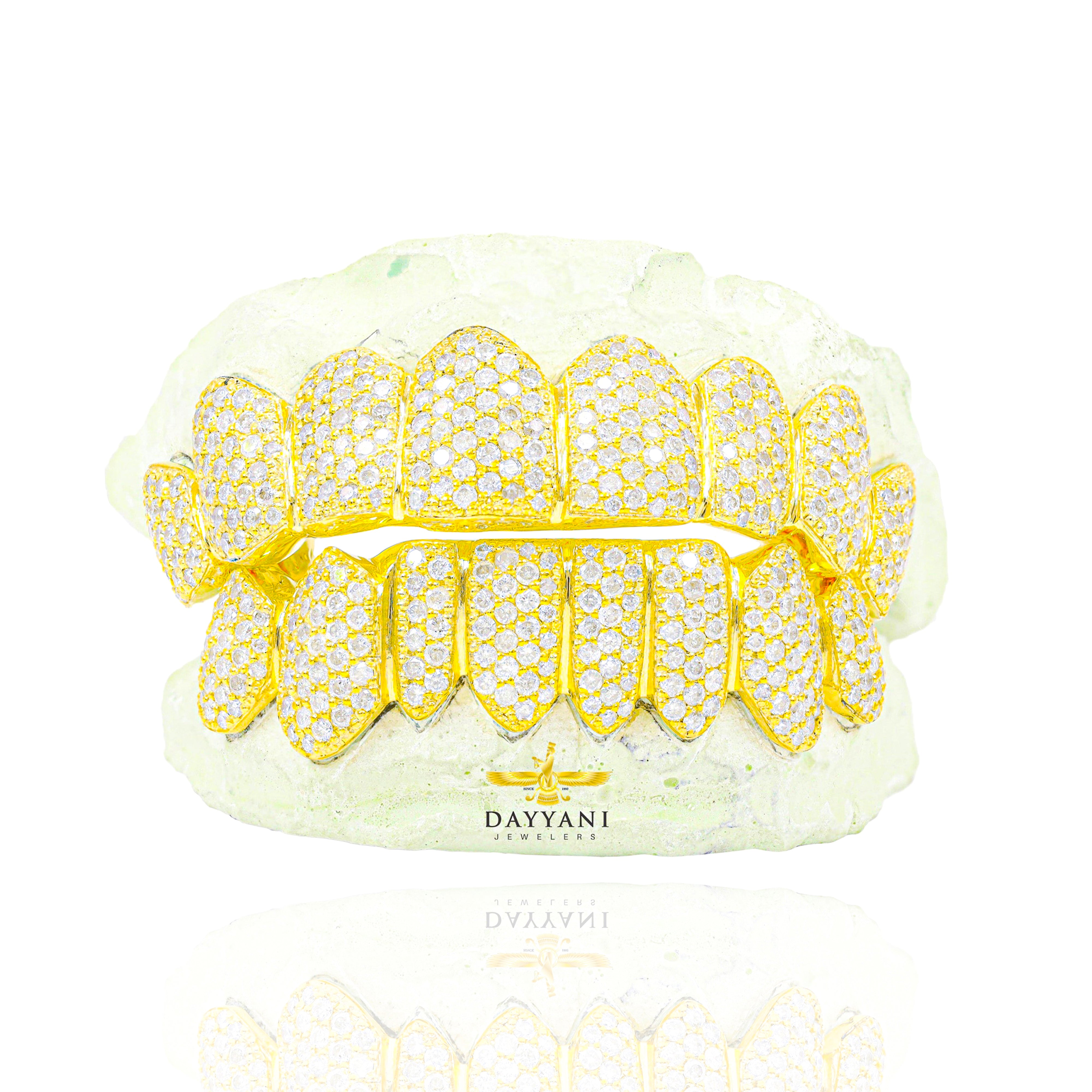 Custom I Clarity Diamond Grillz Hand Set Natural Diamonds Gold Grillz (Zig-Zag Setting)