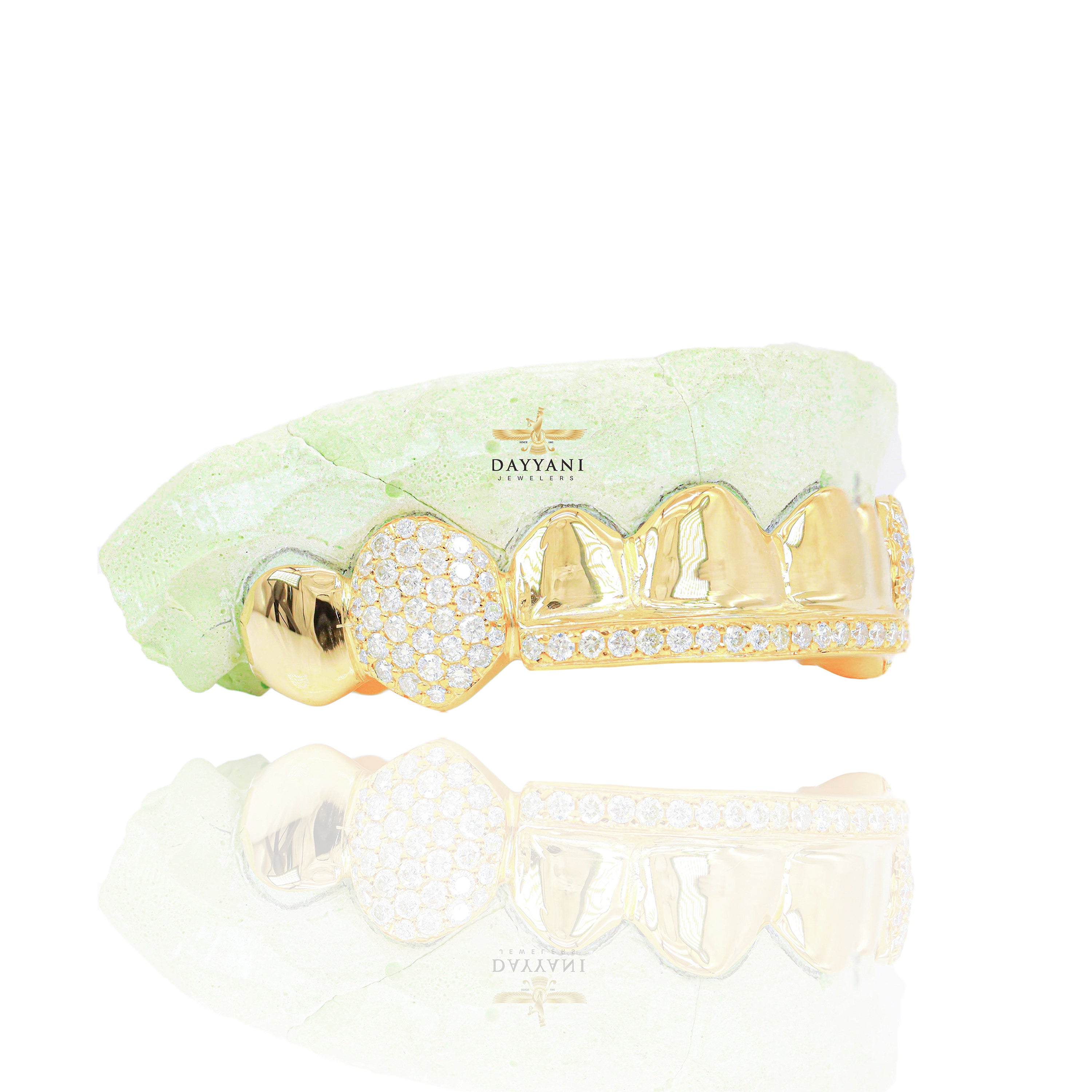 Custom 8 Teeth Grillz with Diamond on Fangs and Diamond Bar Gold Grillz