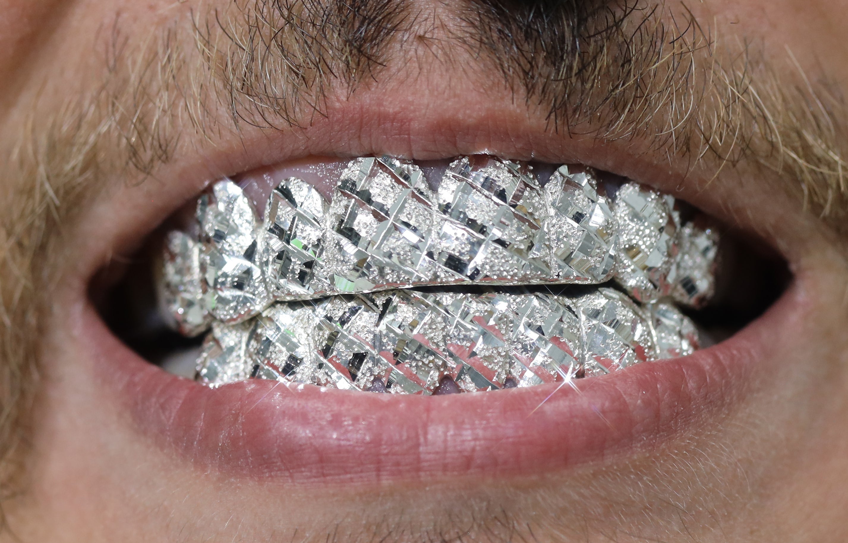 Custom Diamond Cut Diamond Dust Gold Grillz