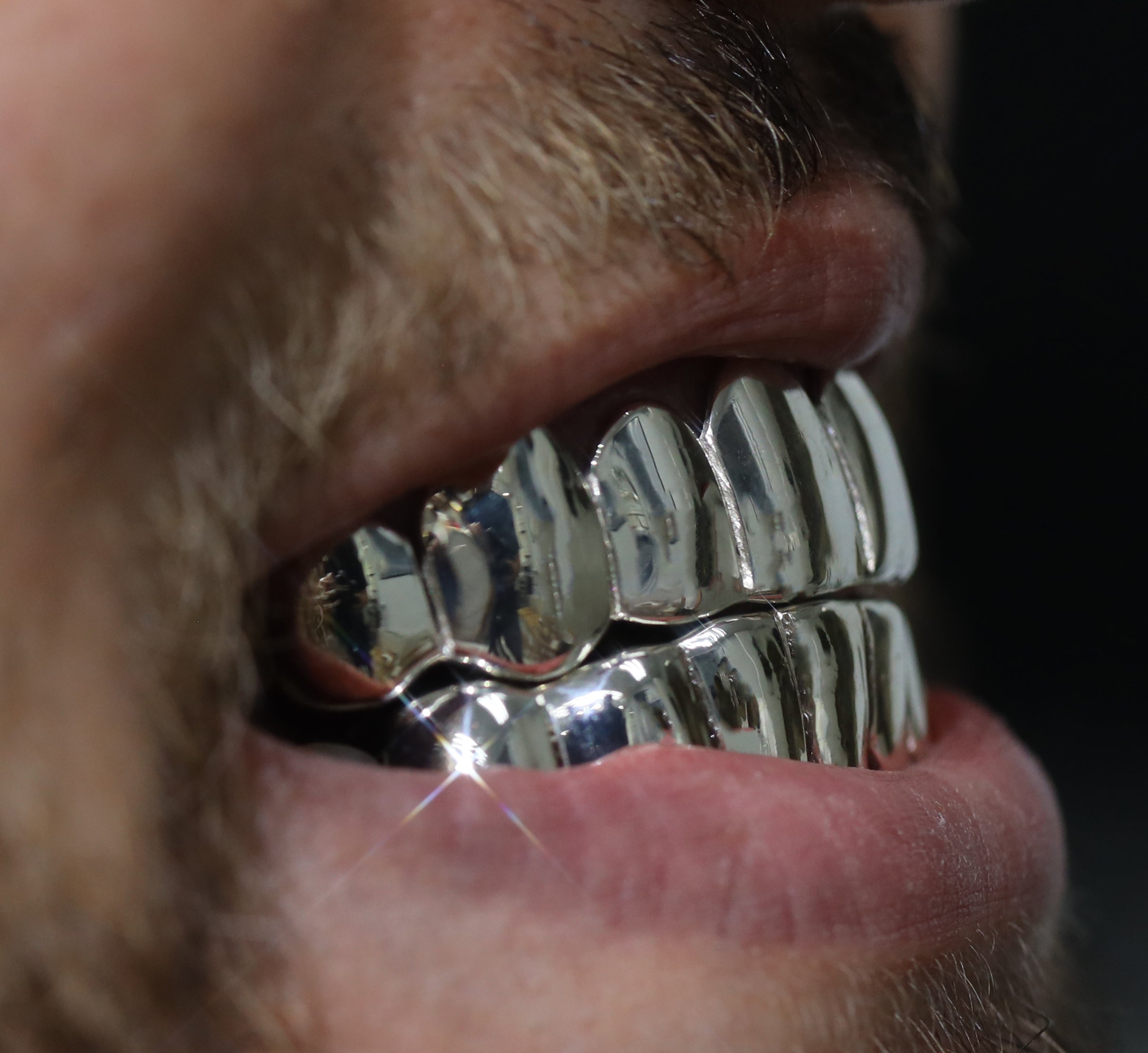Custom Grillz Solid Gold Grillz
