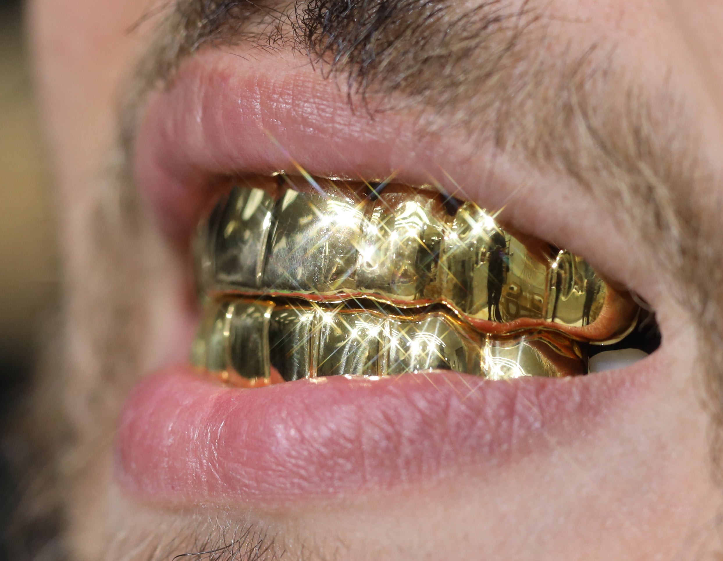 Custom 8 on 8 Gold Grillz