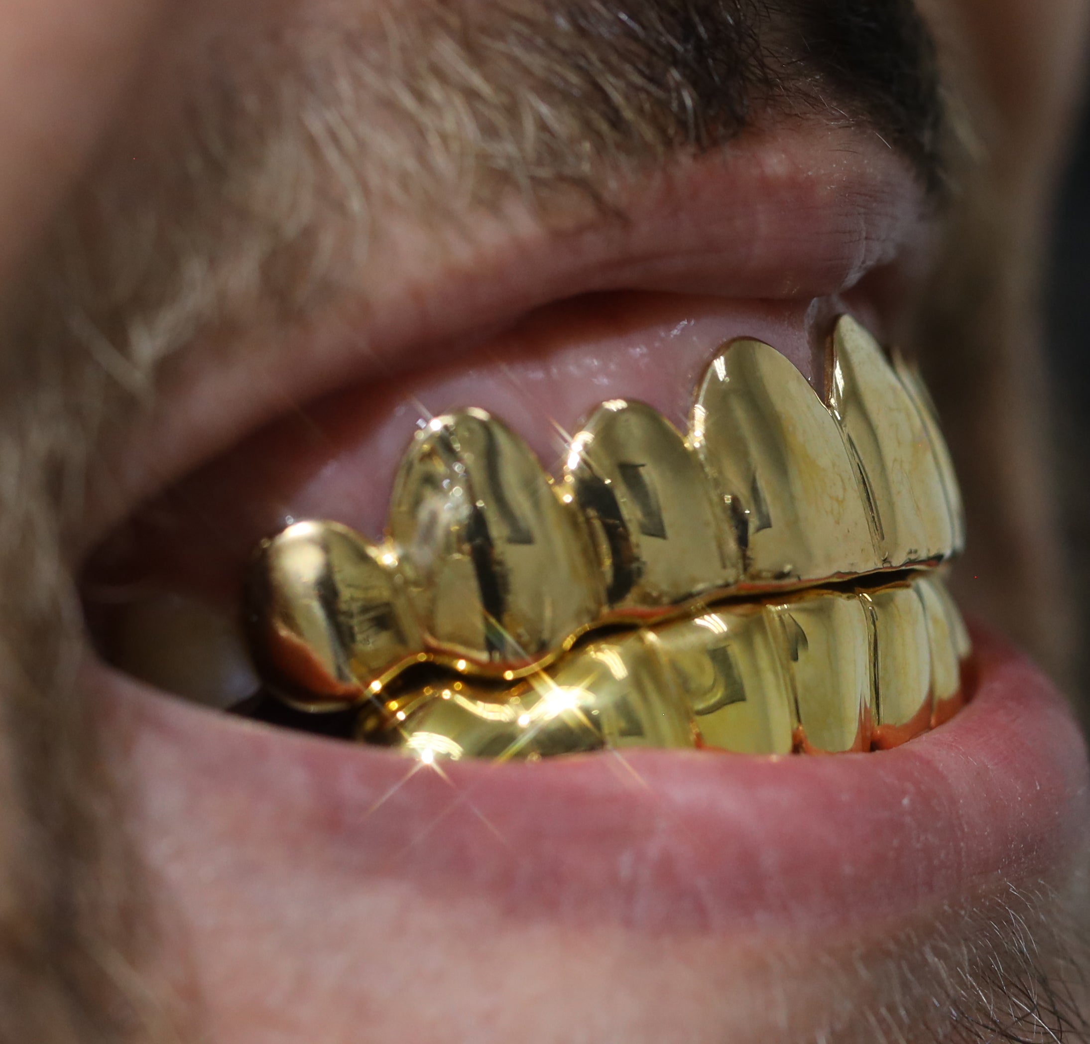 Custom Grillz Solid Gold Grillz
