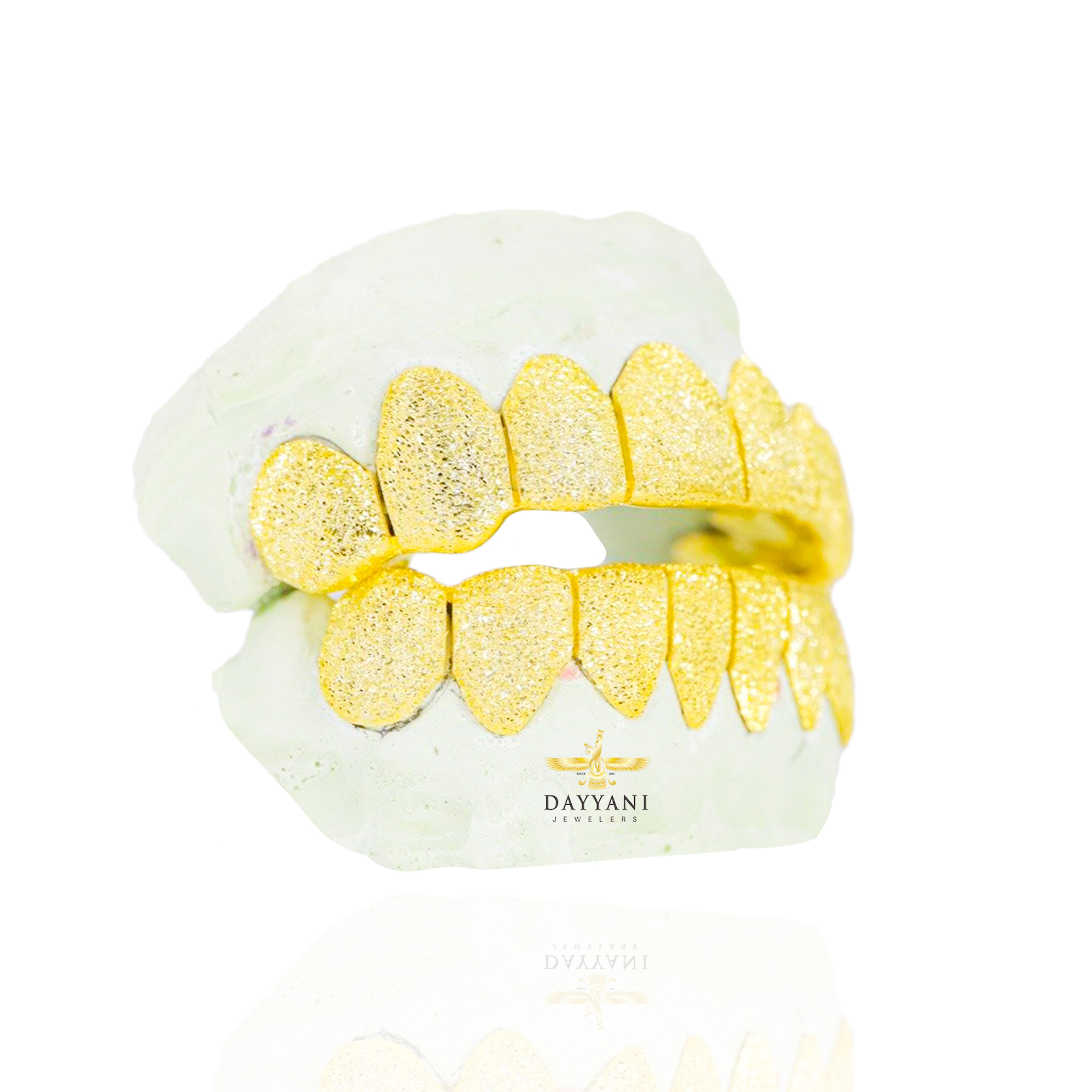 Custom Diamond Dust Gold Grillz