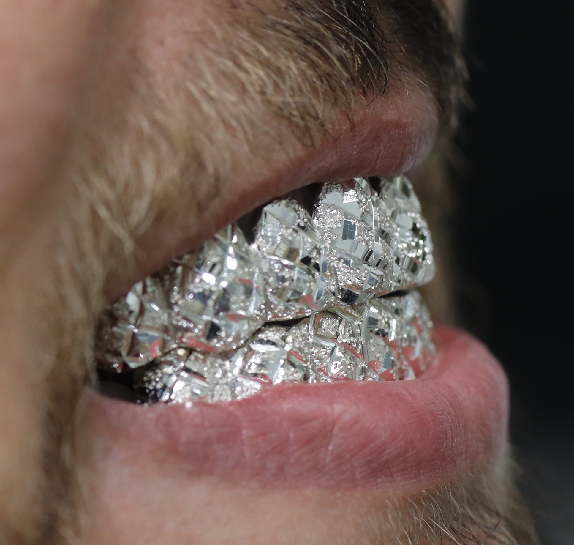 Custom Diamond Cut Diamond Dust Gold Grillz