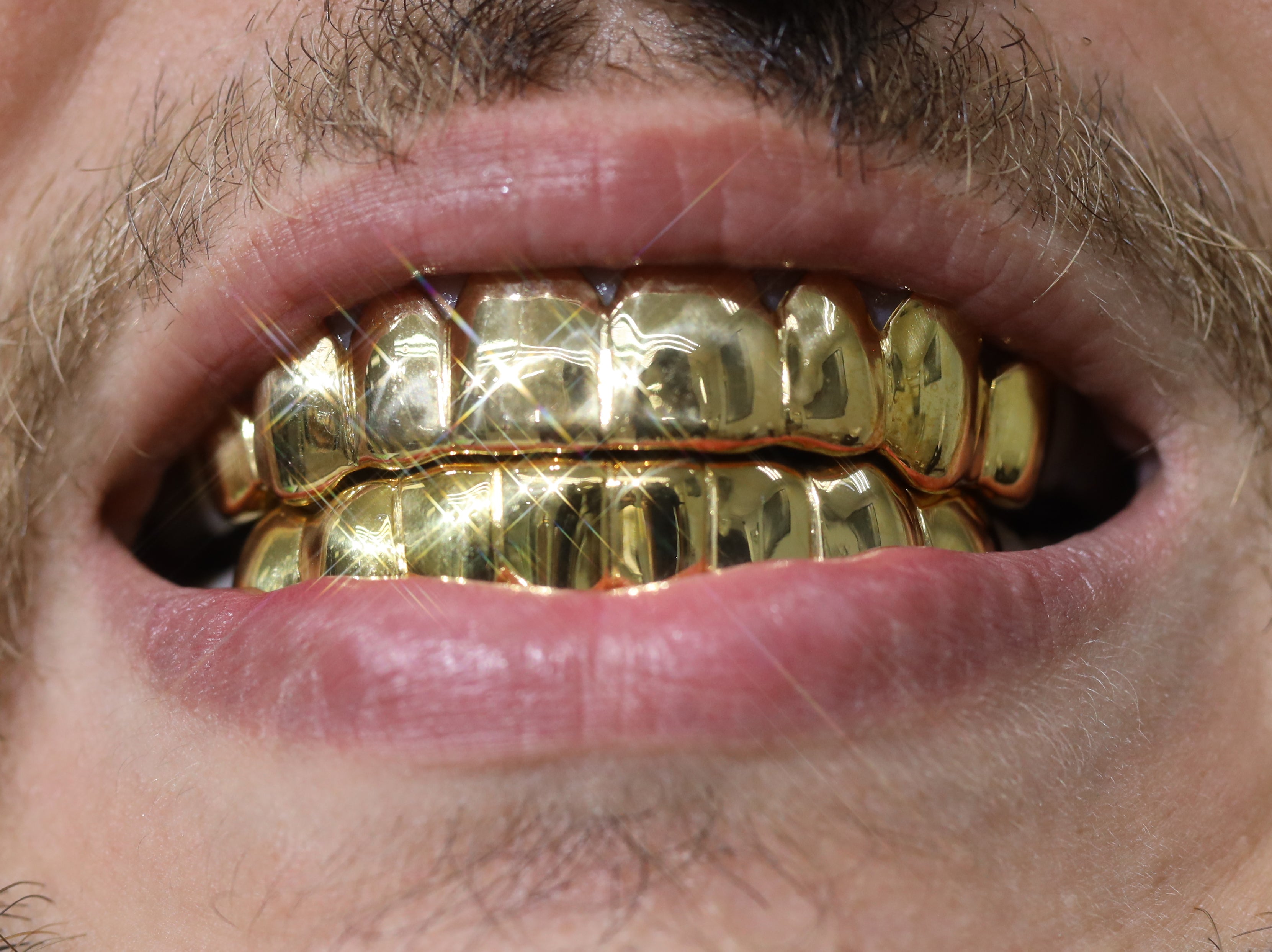 Custom 8 on 8 Gold Grillz