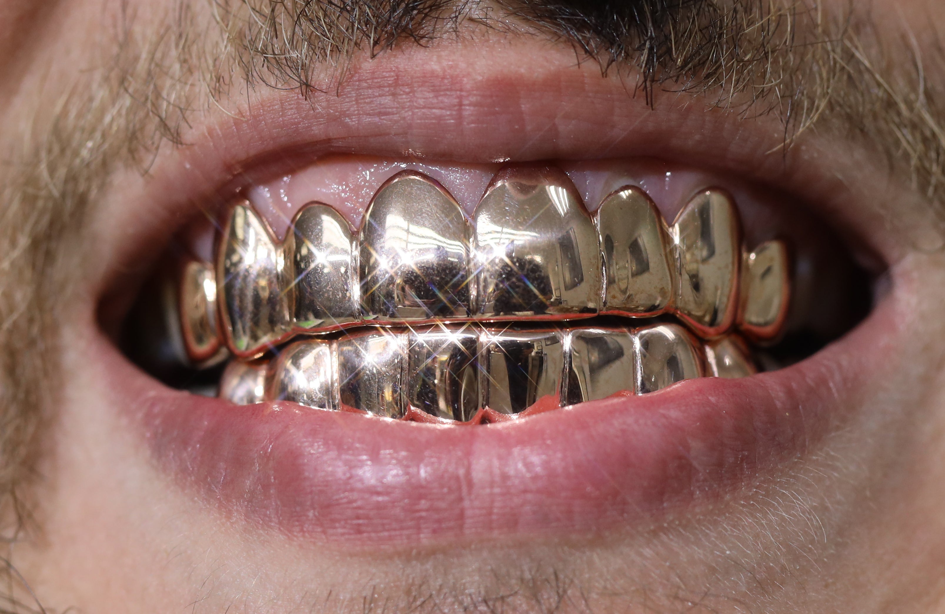 Custom Grillz Solid Gold Grillz