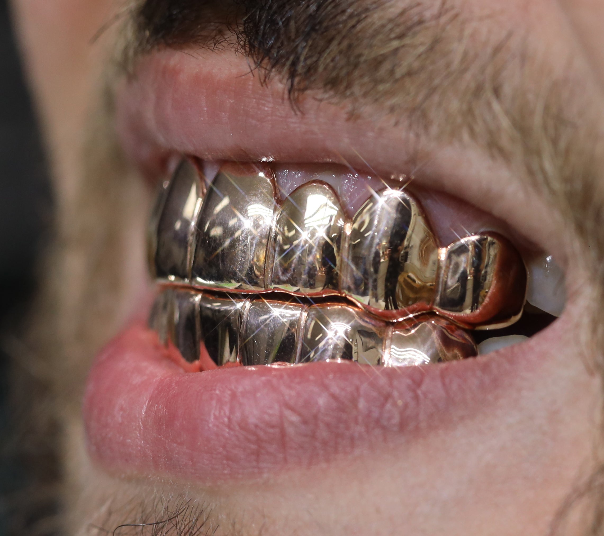 Custom Grillz Solid Gold Grillz