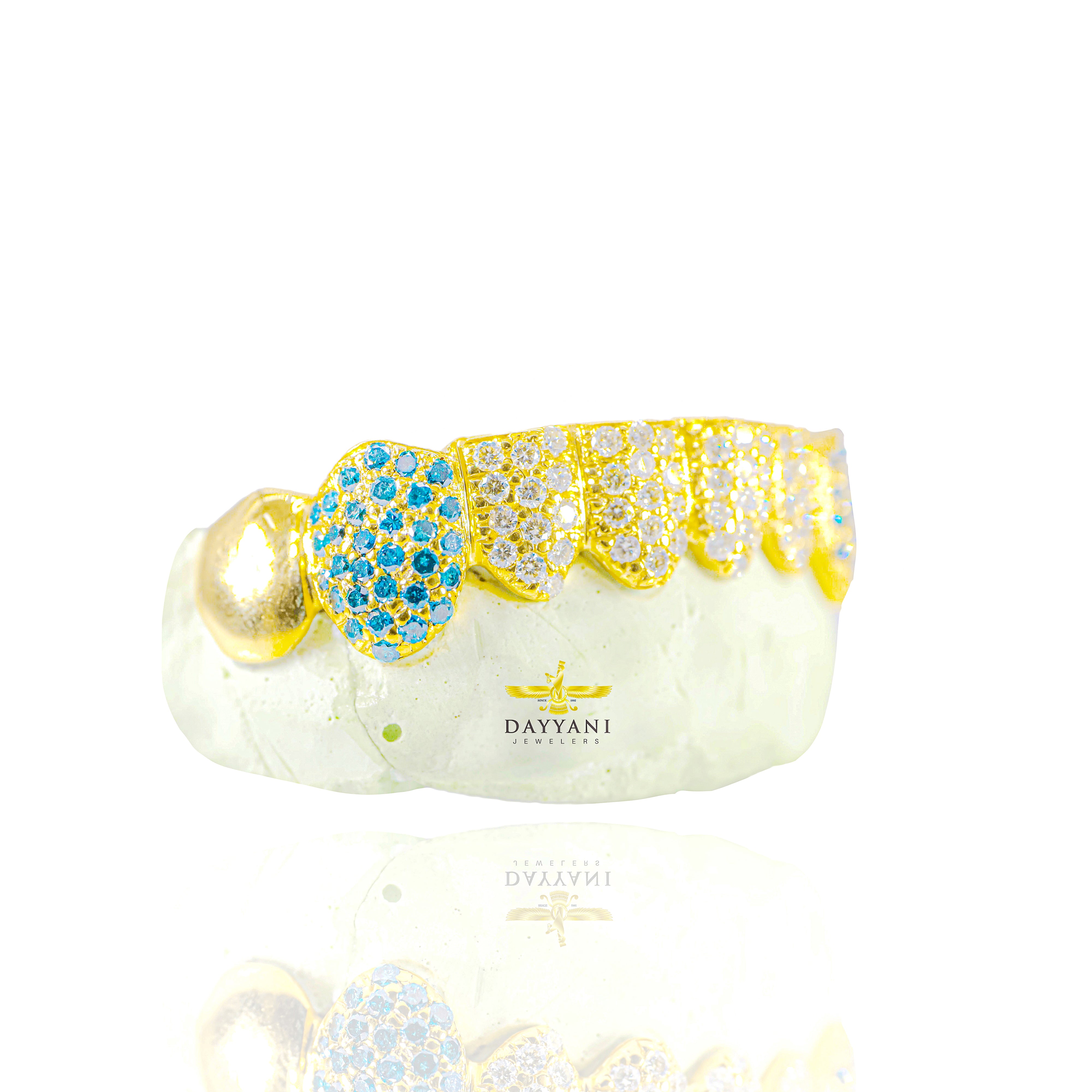 Custom Hand Set Natural White and Blue Diamonds Gold Grillz (Zig-Zag Setting)