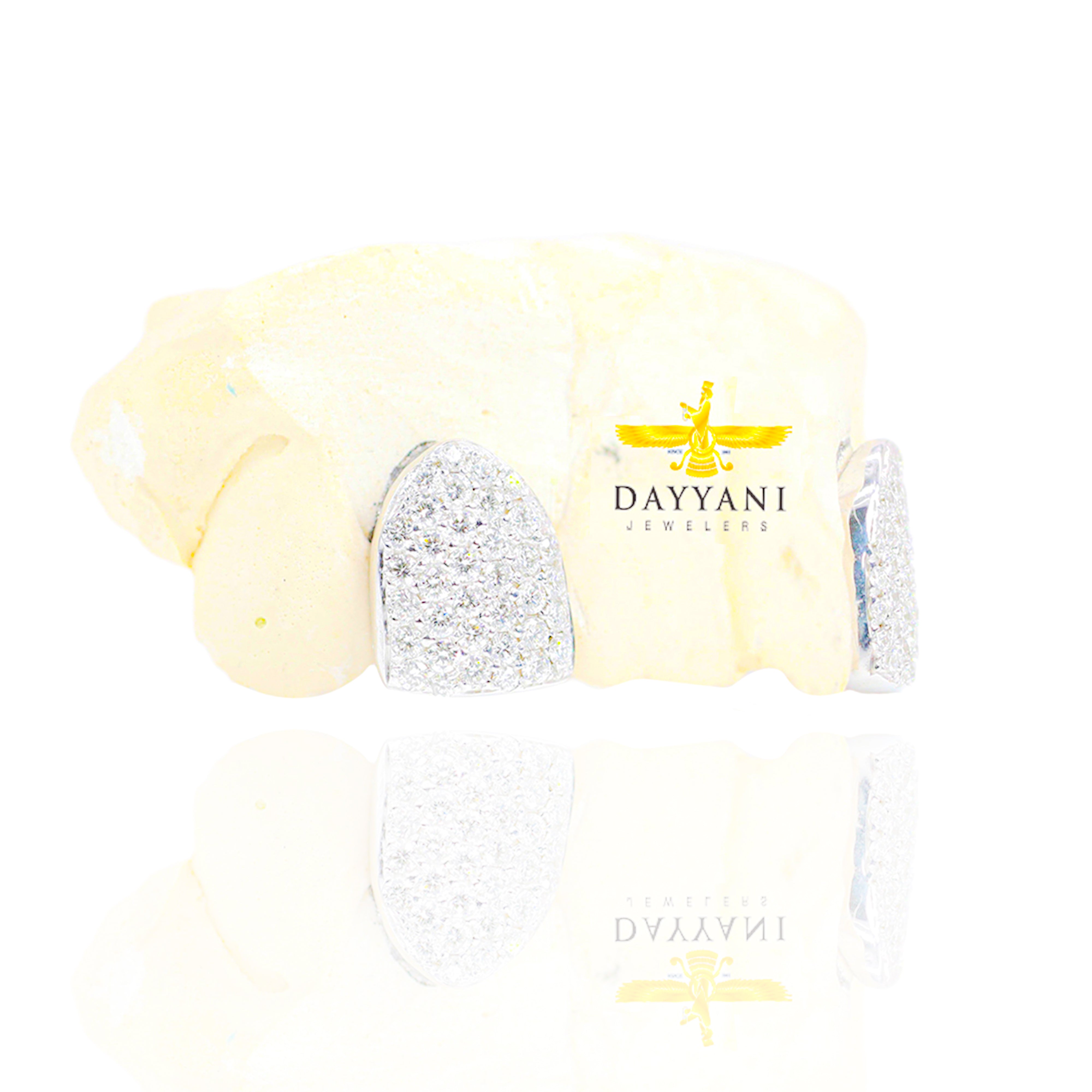 Custom 2 Teeth Incisors Diamond Grillz with Back Bar